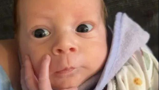 Bebê nasce com os órgãos do lado de fora do corpo