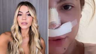 Ex-BBB Hariany surge irreconhecível após três cirurgias: 'Sofri pressão estética'