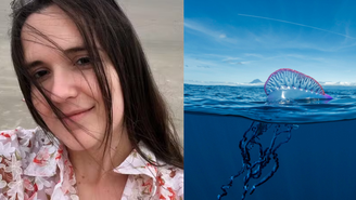 Brenda Gonçalves foi queimada por caravela-portuguesa