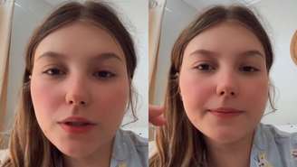 Isabel Veloso, que luta contra um Linfoma de Hodgkin, passou por nova cirurgia; influenciadora retirou pedras na vesícula