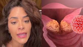 Saiba mais sobre a doneça que fez Aline Campos passa por uma cirurgia