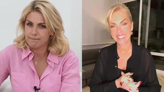 Ana Hickmann antes e depois de emagrecimento