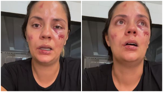 Mulher é arremessada de montanha-russa em parque aquático recém-inaugurado: 'Foi desesperador'