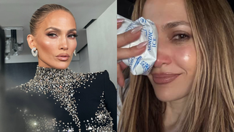Jennifer Lopez sofre acidente em ensaio de premiação e leva pontos no rosto