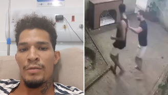 Ambulante de Fernando de Noronha que foi baleado por delegado tem perna amputada