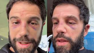 Duda Nagle falou sobre a situação de seu rosto ao retornar na academia