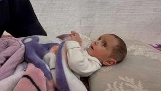 Niveen, de sete meses, precisou de cirurgia no coração fora de Gaza