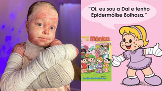 Influenciadora que morreu com doença genética rara vira personagem da Turma da Mônica