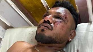 O cidadão britânico Vishwash Kumar Ramesh é, segundo o chefe de polícia local, o único sobrevivente do voo da Air India