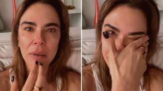 Luciana Gimenez entrega pavor de dormir após fazer cirurgia de hérnia de disco; entenda o que aconteceu com a famosa