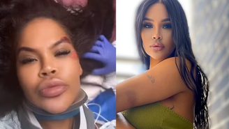 Ex-Big Brother se acidenta e reclama da falta de socorro