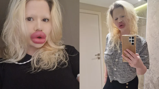 Andrea Ivanova tem os maiores lábios do mundo