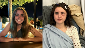 Moli Morgan descobriu um tumor no cérebro aos 22 anos