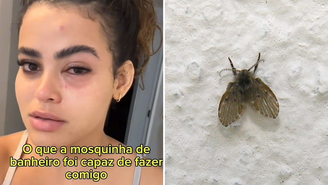 Jovem vai parar no médico após mosca entrar no olho: ‘Desesperada’
