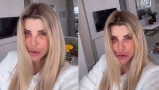 Íris Stefanelli fez cirurgias no rosto