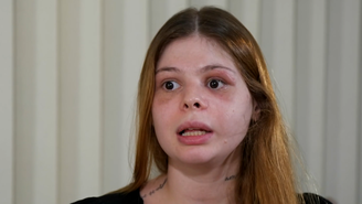 Médica agredida pelo namorado fisiculturista