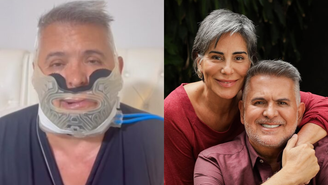 É grave Marido de Gloria Pires passa por cirurgia delicada