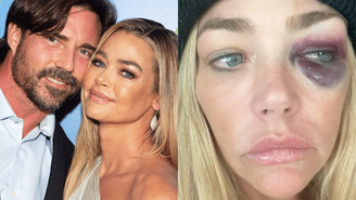 Denise Richards acusa ex-marido Aaron Phypers de agressão