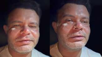 Humorista Aluísio Junior relata que sofreu agressão junto com família na saída do jogo entre Fortaleza e Vasco