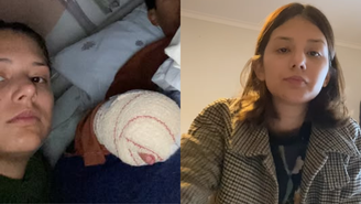 Mãe denuncia bullying em escola; filho teve dedos amputados