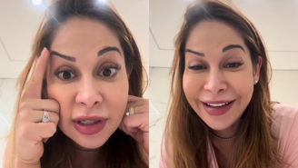 Maíra Cardi fica com sobrancelha torta após botox dar errado