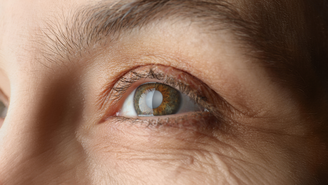 No Brasil, a exposição dos olhos ao sol sem proteção é responsável por provocar 100 mil novos casos de catarata por ano