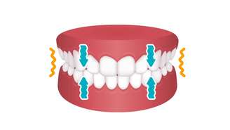 Ranger noturno pode ser tão intenso que só é percebido pelos ruídos durante o sono – depositphotos.com / barks