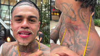 MC cabelinho mostra pescoço arranhado após confusão no Pelourinho