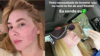 Virginia mostra rosto inchado após procedimento