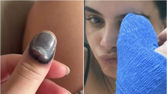 Atriz Carol Macedo prende o dedo na porta do carro e precisa passar por cirurgia / Reprodução: Instagram