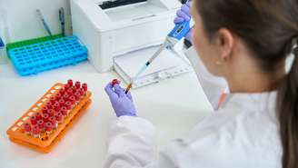 A ideia central da dieta é que indivíduos com sangue A, B, AB ou O reagiriam de forma diferente a determinados alimentos – depositphotos.com / svitlanahulko85.gmail.com