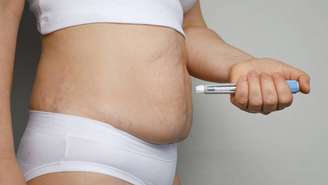 Caneta emagrecedora – depositphotos.com / MillaFedotova