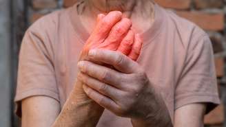 Saúde reumática no verão exige cuidados extras com sol, hidratação e rotina; entenda como o calor impacta doenças reumáticas 