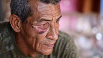 O impacto do míssil lançou Wilman González contra a parede, enquanto sua tia Rosa perdeu a vida