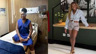 Veja os cuidados do pós