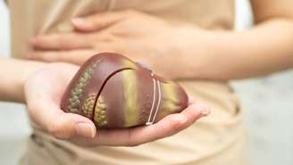 Amido resistente no dia a dia pode reduzir a gordura no fígado e favorecer a microbiota; confira alimentos que protegem a região