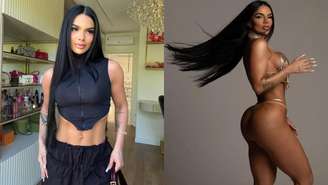 Conheça a cirurgia estética de remodelação glútea