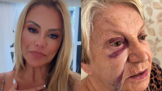 Mãe de Poliana Rocha, aos 84 anos, sofre acidente e fica com hematomas no rosto / Reprodução: Instagram