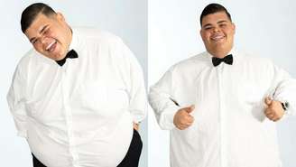 Entenda detalhes da bariátrica de Gordão da XJ