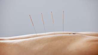 Veja os benefícios da acupuntura para casos de doenças autoimunes