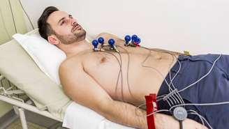 O eletrocardiograma, conhecido como ECG, é um exame que registra a atividade elétrica do coração por meio de eletrodos colocados na pele – depositphotos.com / boggy22
