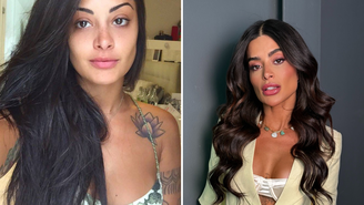 Antes e depois: veja a transformação do rosto de Aline Campos