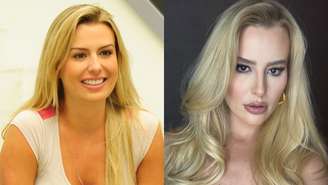 Fernanda Keulla fala sobre doença autoimune