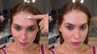 Virginia expõe marcas causadas por fantasia após ensaio da Grande Rio