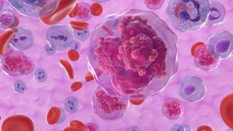 A leucemia é um câncer das células brancas do sangue, os leucócitos – depositphotos.com / forfour
