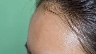 pele oleosa – depositphotos.com / zaynyinyi