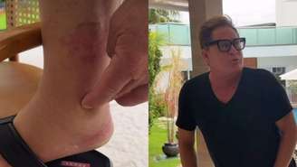 Leonardo diverte a web ao culpar 'cachaça' por pé inchado e dá resposta sincerona a Poliana