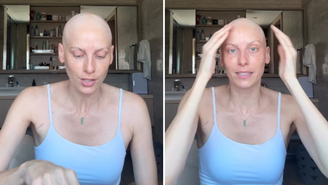 Com câncer, atriz ex-SBT desabafa sobre quimioterapia e reforça importância do SUS: ‘Sou privilegiada’