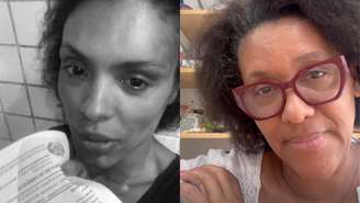 Lidi Lisboa fica ferida no rosto após reagir a assalto e mãe faz apelo: 'Faça diferente'