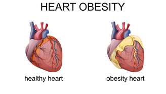 A gordura ao redor do coração existe, mas em excesso vira sinal de alerta – depositphotos.com / Artemida-psy